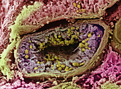 Seminiferous tubule of testis