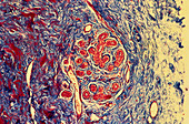 Light micrograph of normal female breast tissue