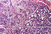 Glandular tissue in a human breast