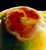 False-colour SEM of the surface of ovary