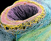 Coloured SEM of a cut human umbilical cord & vein