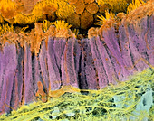 Coloured SEM of epithelium in the Fallopian tube
