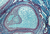 LM of a graafian follicle in the ovary
