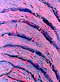 Colour SEM of cells shedding on vaginal epithelium