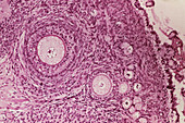 LM of section through an ovary showing follicles