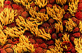 Coloured SEM of fallopian tube cilia & microvilli