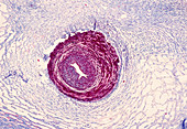 Umbilical cord,light micrograph
