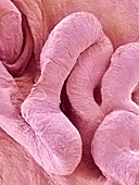 Placental villi,SEM