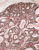 Lactating breast tissue,light micrograph