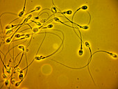 LM of a field of human sperm