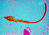 False-colour TEM of a human sperm
