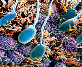 SEM of human sperm in the uterus