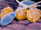 F. colour SEM of sperm being attacked by leucocyte