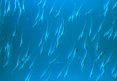 Light micrograph of swimming human sperm