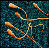 Coloured SEM of human spermatozoa