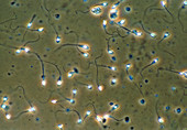 Light micrograph of human sperm cells