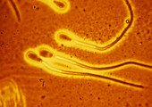 Light micrograph of sperm from a bull