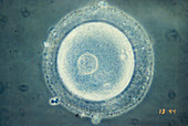 Immature human oocyte,light micrograph