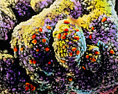 Coloured SEM of primordial egg cells