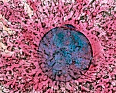 Coloured LM of mature human oocyte with polar body