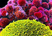 Colour SEM of human egg with corona radiata cells