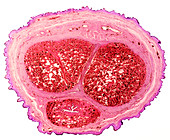 Penis section,light micrograph