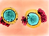 Coloured LM of two fertilised polyspermic eggs