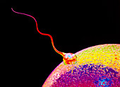 Computer art of sperm and egg during fertilisation