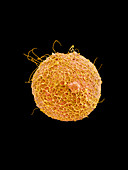 Coloured SEM of sperm on egg during fertilisation