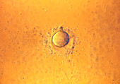 LM of sperm on egg during fertilisation