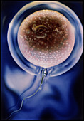 Artwork of a human sperm fertilising an egg