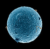 Human egg cell and sperm cells,ESEM