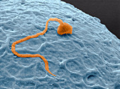 Sperm cell fertilising an egg cell,ESEM