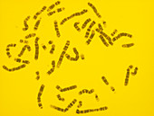 Light micrograph of a set of male chromosomes