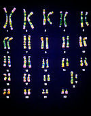 False-colour LM of a set of male chromosomes