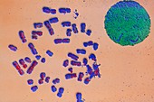 F/colour SEM of full number of human chromosomes