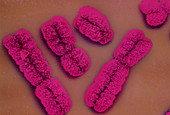 False-colour SEM of human chromosomes