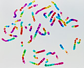 Coloured LM of a normal male karyotype