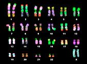 Fluorescence LM of a normal human female karyotype