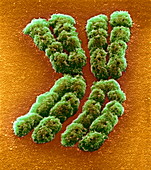 Doubled chromosome,SEM
