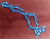 Lampbrush chromosomes,TEM