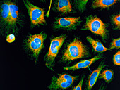 Immunofluorescent LM: mitosis in HeLa cancer cells