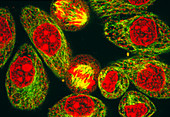 Immunofluorescent LM of dividing HeLa cells