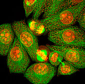 Mitosis,light micrograph