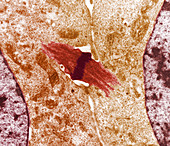 Mitotic cell division,TEM