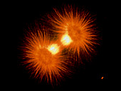 Sea urchin cell division