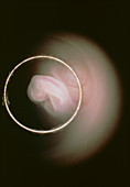 Human foetus showing ear