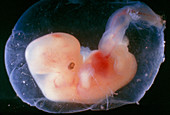 Embryo aged 6 weeks