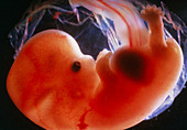 7 week old embryo