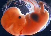 Human embryo at around 7 weeks